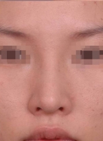 NJH Plastic Surgery,Reviews,Images, Promotions — Korea cost, reviews & before-after | MISOODA