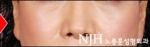 NJH Plastic Surgery,Reviews,Images, Promotions — Korea cost, reviews & before-after | MISOODA