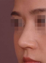 NJH Plastic Surgery,Reviews,Images, Promotions — Korea cost, reviews & before-after | MISOODA