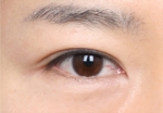 NJH Plastic Surgery,Reviews,Images, Promotions — Korea cost, reviews & before-after | MISOODA