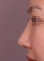 NJH Plastic Surgery,Reviews,Images, Promotions — Korea cost, reviews & before-after | MISOODA