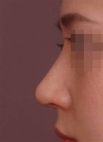 NJH Plastic Surgery,Reviews,Images, Promotions — Korea cost, reviews & before-after | MISOODA