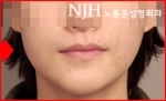 NJH Plastic Surgery,Reviews,Images, Promotions — Korea cost, reviews & before-after | MISOODA