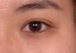 NJH Plastic Surgery,Reviews,Images, Promotions — Korea cost, reviews & before-after | MISOODA