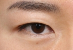 NJH Plastic Surgery,Reviews,Images, Promotions — Korea cost, reviews & before-after | MISOODA