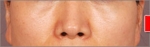NJH Plastic Surgery,Reviews,Images, Promotions — Korea cost, reviews & before-after | MISOODA