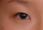 NJH Plastic Surgery,Reviews,Images, Promotions — Korea cost, reviews & before-after | MISOODA