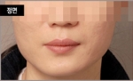 NJH Plastic Surgery,Reviews,Images, Promotions — Korea cost, reviews & before-after | MISOODA