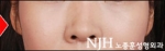 NJH Plastic Surgery,Reviews,Images, Promotions — Korea cost, reviews & before-after | MISOODA