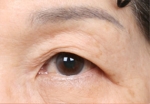 NJH Plastic Surgery,Reviews,Images, Promotions — Korea cost, reviews & before-after | MISOODA
