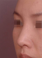 NJH Plastic Surgery,Reviews,Images, Promotions — Korea cost, reviews & before-after | MISOODA