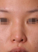 NJH Plastic Surgery,Reviews,Images, Promotions — Korea cost, reviews & before-after | MISOODA