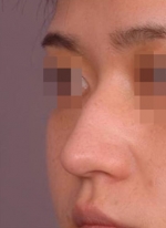 NJH Plastic Surgery,Reviews,Images, Promotions — Korea cost, reviews & before-after | MISOODA