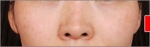 NJH Plastic Surgery,Reviews,Images, Promotions — Korea cost, reviews & before-after | MISOODA