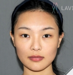 facial contouring
