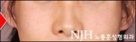 NJH Plastic Surgery,Reviews,Images, Promotions — Korea cost, reviews & before-after | MISOODA
