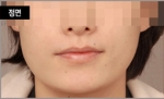 NJH Plastic Surgery,Reviews,Images, Promotions — Korea cost, reviews & before-after | MISOODA