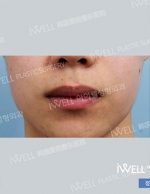 lip