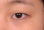 NJH Plastic Surgery,Reviews,Images, Promotions — Korea cost, reviews & before-after | MISOODA