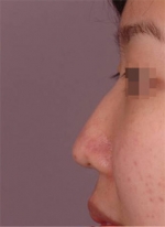 NJH Plastic Surgery,Reviews,Images, Promotions — Korea cost, reviews & before-after | MISOODA