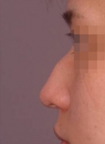 NJH Plastic Surgery,Reviews,Images, Promotions — Korea cost, reviews & before-after | MISOODA