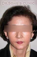 Apgujeong Dream Plastic Surgery Clinic,Reviews,Images, Promotions — Korea cost, reviews & before-after | MISOODA