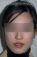 Apgujeong Dream Plastic Surgery Clinic,Reviews,Images, Promotions — Korea cost, reviews & before-after | MISOODA