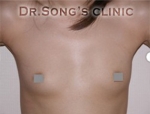 Apgujeong Dream Plastic Surgery Clinic,Reviews,Images, Promotions — Korea cost, reviews & before-after | MISOODA