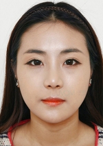 facial contouring