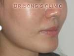 Apgujeong Dream Plastic Surgery Clinic,Reviews,Images, Promotions — Korea cost, reviews & before-after | MISOODA