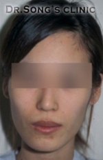 Apgujeong Dream Plastic Surgery Clinic,Reviews,Images, Promotions — Korea cost, reviews & before-after | MISOODA