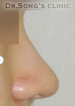 Apgujeong Dream Plastic Surgery Clinic,Reviews,Images, Promotions — Korea cost, reviews & before-after | MISOODA