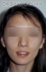 Apgujeong Dream Plastic Surgery Clinic,Reviews,Images, Promotions — Korea cost, reviews & before-after | MISOODA