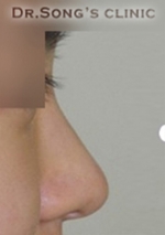 Apgujeong Dream Plastic Surgery Clinic,Reviews,Images, Promotions — Korea cost, reviews & before-after | MISOODA