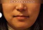 Apgujeong Dream Plastic Surgery Clinic,Reviews,Images, Promotions — Korea cost, reviews & before-after | MISOODA