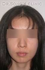 Apgujeong Dream Plastic Surgery Clinic,Reviews,Images, Promotions — Korea cost, reviews & before-after | MISOODA