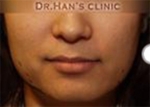 Apgujeong Dream Plastic Surgery Clinic,Reviews,Images, Promotions — Korea cost, reviews & before-after | MISOODA