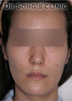 Apgujeong Dream Plastic Surgery Clinic,Reviews,Images, Promotions — Korea cost, reviews & before-after | MISOODA