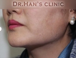 Apgujeong Dream Plastic Surgery Clinic,Reviews,Images, Promotions — Korea cost, reviews & before-after | MISOODA