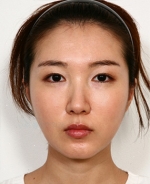 facial contouring