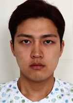 facial contouring
