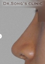 Apgujeong Dream Plastic Surgery Clinic,Reviews,Images, Promotions — Korea cost, reviews & before-after | MISOODA
