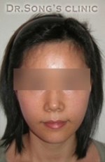 Apgujeong Dream Plastic Surgery Clinic,Reviews,Images, Promotions — Korea cost, reviews & before-after | MISOODA
