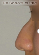 Apgujeong Dream Plastic Surgery Clinic,Reviews,Images, Promotions — Korea cost, reviews & before-after | MISOODA