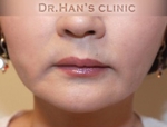 Apgujeong Dream Plastic Surgery Clinic,Reviews,Images, Promotions — Korea cost, reviews & before-after | MISOODA