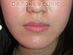Apgujeong Dream Plastic Surgery Clinic,Reviews,Images, Promotions — Korea cost, reviews & before-after | MISOODA