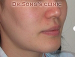 Apgujeong Dream Plastic Surgery Clinic,Reviews,Images, Promotions — Korea cost, reviews & before-after | MISOODA