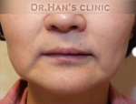 Apgujeong Dream Plastic Surgery Clinic,Reviews,Images, Promotions — Korea cost, reviews & before-after | MISOODA