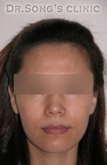 Apgujeong Dream Plastic Surgery Clinic,Reviews,Images, Promotions — Korea cost, reviews & before-after | MISOODA