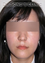 Apgujeong Dream Plastic Surgery Clinic,Reviews,Images, Promotions — Korea cost, reviews & before-after | MISOODA